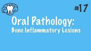 Odontogenic Keratocyst  Clinical Radiographic and Histopathologic Features [upl. by Yelserp]