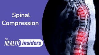 Symptoms of Spinal Compression Fractures [upl. by Streeto]