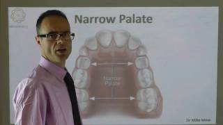 A Narrow Palate By Dr Mike Mew [upl. by Yrrot]