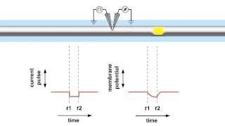 An Electrophysiology Study [upl. by Luapnoj944]