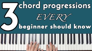 Common Chord Progressions Every Beginner Should Know [upl. by Ahsya]