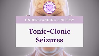 What are TonicClonic Seizures [upl. by Caruso]