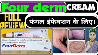 Four derm cream use in hindi  Fourderm cream side effects  best antifungal cream [upl. by Acirahs]