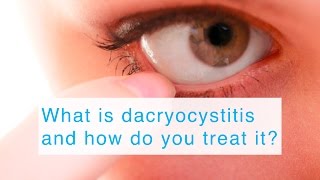 What is dacryocystitis and how do you treat it [upl. by Aketahs]