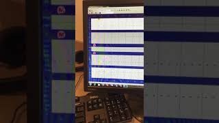 Xrays and Perio Chart for Dentrix [upl. by Pepillo611]