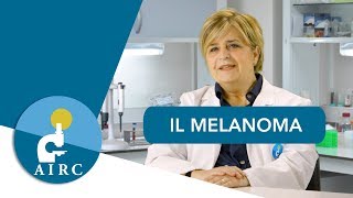 Melanoma della pelle sintomi prevenzione cause diagnosi [upl. by Castorina]