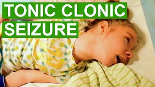 Tonic Clonic Seizure Video [upl. by Onek869]