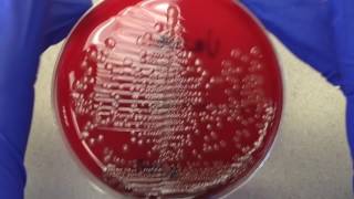 Plate Reading  Urine I [upl. by Inattirb]