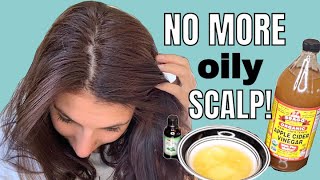 LIFE CHANGING DIY Hair mask for OILY HAIR  NO MORE OILY SCALP [upl. by Hcelemile]