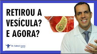 VOCÊ RETIROU A VESÍCULA O QUE FAZER AGORA  Dr Gabriel Azzini [upl. by Hamon]