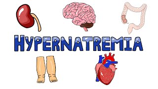 An Approach to Hypernatremia  Hypernatremia Diagnostic Algorithm  Hypernatremia Causes MADE EASY [upl. by Sussna]