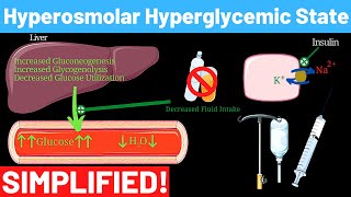 Hyperosmolar Hyperglycemic Nonketotic Syndrome  Panmedicad [upl. by Llywellyn]