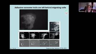 Function of exosome secretion in cancer cell migration and tumor aggressiveness by Alissa Weaver [upl. by Sitelc]