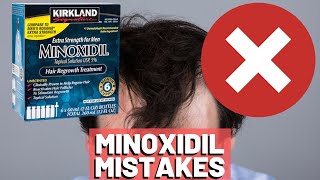 5 BIGGEST MISTAKES When Using Minoxidil REVEALED [upl. by Teodorico987]