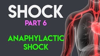 Anaphylaxis and Anaphylactic Shock [upl. by Llerihs]