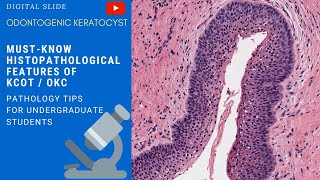 Odontogenic Keratocyst Histopathology [upl. by Emarej]