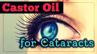 Castor Oil For Cataracts Does It Work And How To Use It [upl. by Anirec]