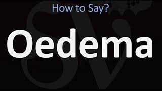 How to Pronounce Oedema CORRECTLY [upl. by Urien]