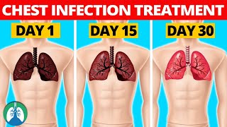 7 Natural Chest Infection Treatments Home Remedies [upl. by Lraed]