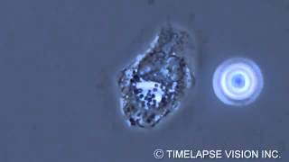 Bacterial phagocytosis by neutrophils [upl. by Man]