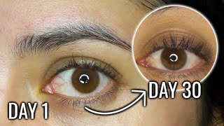 CASTOR OIL FOR EYELASH GROWTH  30 DAY BEFORE AND AFTER RESULTS [upl. by Allred]