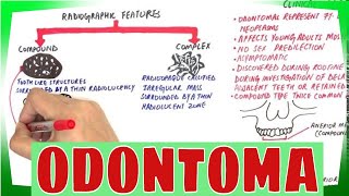 Oral Pathology  Bone Inflammatory Lesions  INBDE ADAT [upl. by Sheeree]