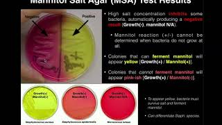 Mannitol  Osmotic Diuretic  NCLEX Study Tips [upl. by Anerbes560]