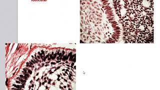 Odontogenic Tumors [upl. by Salokin]