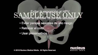 Diferencia entre QUIMIOTERAPIA y RADIOTERAPIA para el cáncer [upl. by Nonez284]