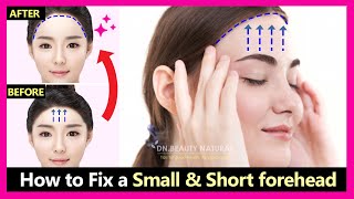 How to fix narrow amp small forehead  Increase your forehead size amp width naturally  Japan Exercises [upl. by Disharoon]