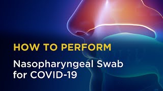 Nasopharyngeal Swab for COVID19 [upl. by Malinde]