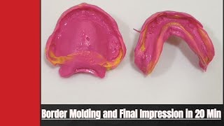 Border Molding  Peripheral Tracing and Final Impression Using Elastomeric impression Material [upl. by Retsevlys]