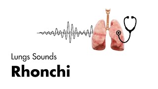 Rhonchi  Lung Sounds  Medzcool [upl. by Dinsmore]