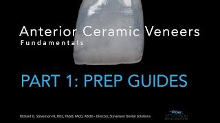 Anterior Ceramic Veneers Part 1 Preparation Guides [upl. by Rea]