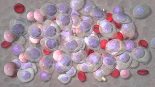 Multiple myeloma treatment at Mayo Clinic [upl. by Mahseh56]