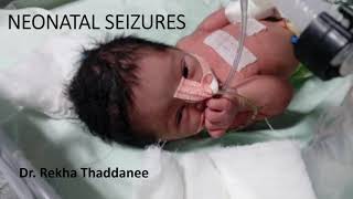 Neonatal Seizures  Pediatrics [upl. by Allit527]