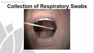 Rapid antigen screening [upl. by Sukramaj]