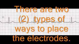 THE PLACEMENT OF A 3 LEAD ECG [upl. by Mariya62]