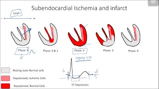 Cardiovascular  Electrophysiology  Intrinsic Cardiac Conduction System [upl. by Ybab703]