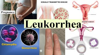 leukorrhea [upl. by Yelrehs]