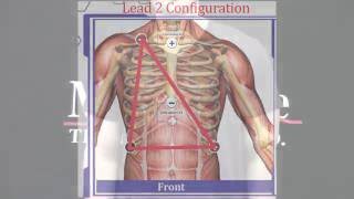 Electrode Placement Training for Electrocardiogram ECG [upl. by Animrac]