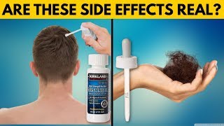 REAL TRUTH About Minoxidil Side Effects [upl. by Tnilk]