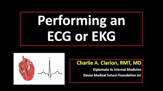 ECG Electrode Placement [upl. by Mou]