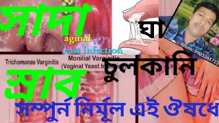 সাদা স্রাব ও যোনিদ্বারে চুলকানি Leucorrhoea হোমিও ঔষধ  Dr A K  Maitra  Kol [upl. by Honor]