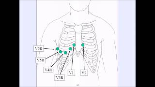 How To Complete Right Side ECG [upl. by Ralina175]