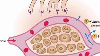 Mechanisms of edema development [upl. by Yhcir102]