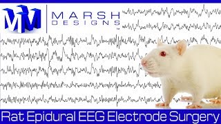 2Minute Neuroscience Electroencephalography EEG [upl. by Zedekiah]