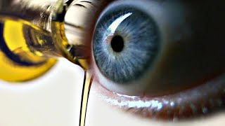 Does Castor Oil Help with Cataracts [upl. by Htabmas396]