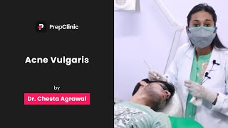 Acne Vulgaris  Dr Chesta Agrawal  Dermatology PrepClinic [upl. by Teodoro176]