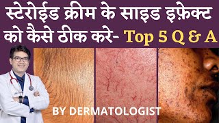 Steroid Cream side effects Treatment  कैसे ठीक करे  Top 5 QampA for Steroid Cream Side Effects [upl. by Gussman470]